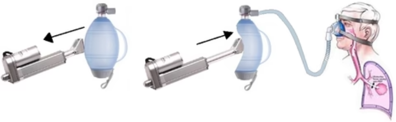 What is the purpose of a home ventilator?